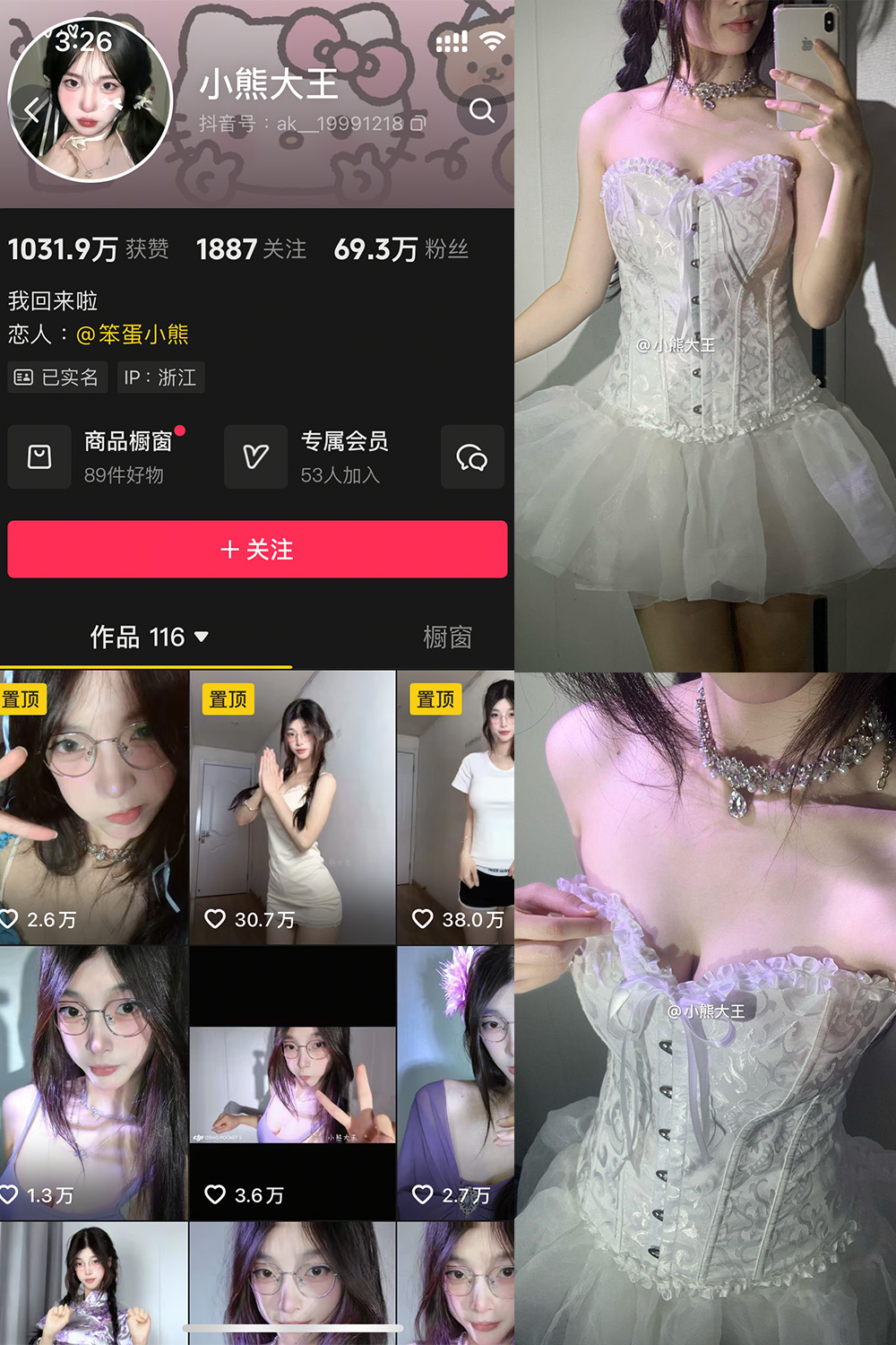 抖音 小熊大王 微密圈 001期 【32P】-私密花园